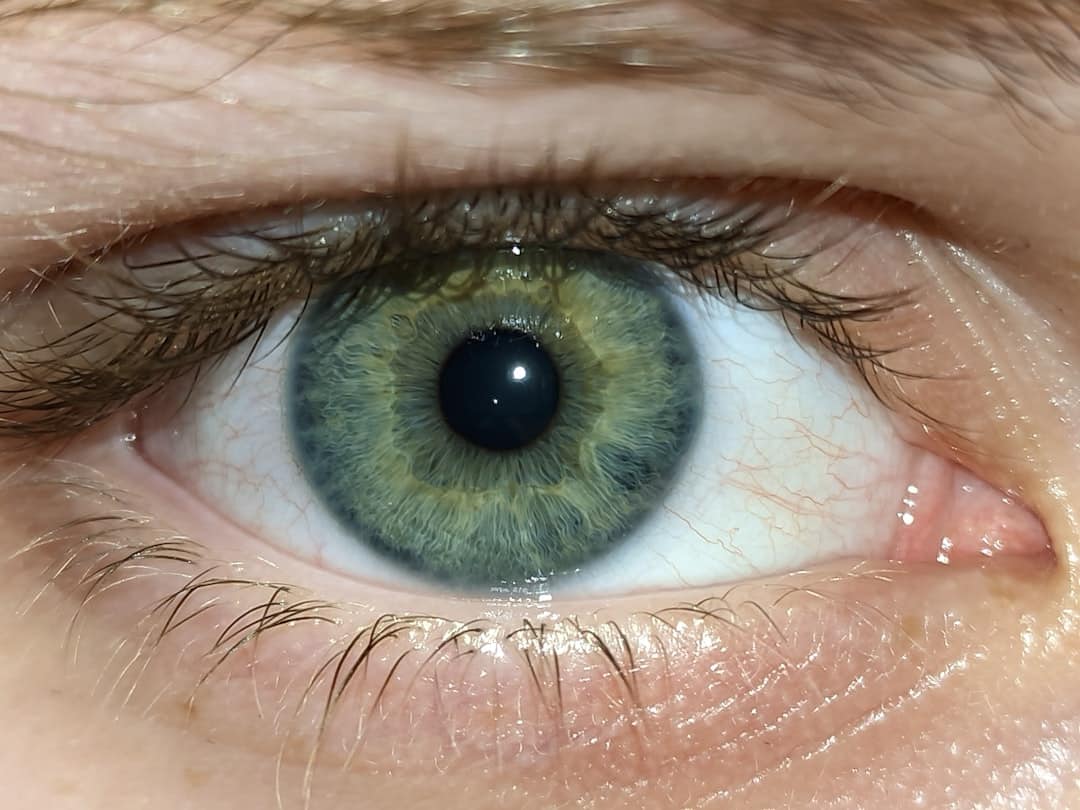 Photo Eye exam